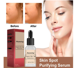 Skin Care Solution to Remove Dark Nevus and Warts (1pc)